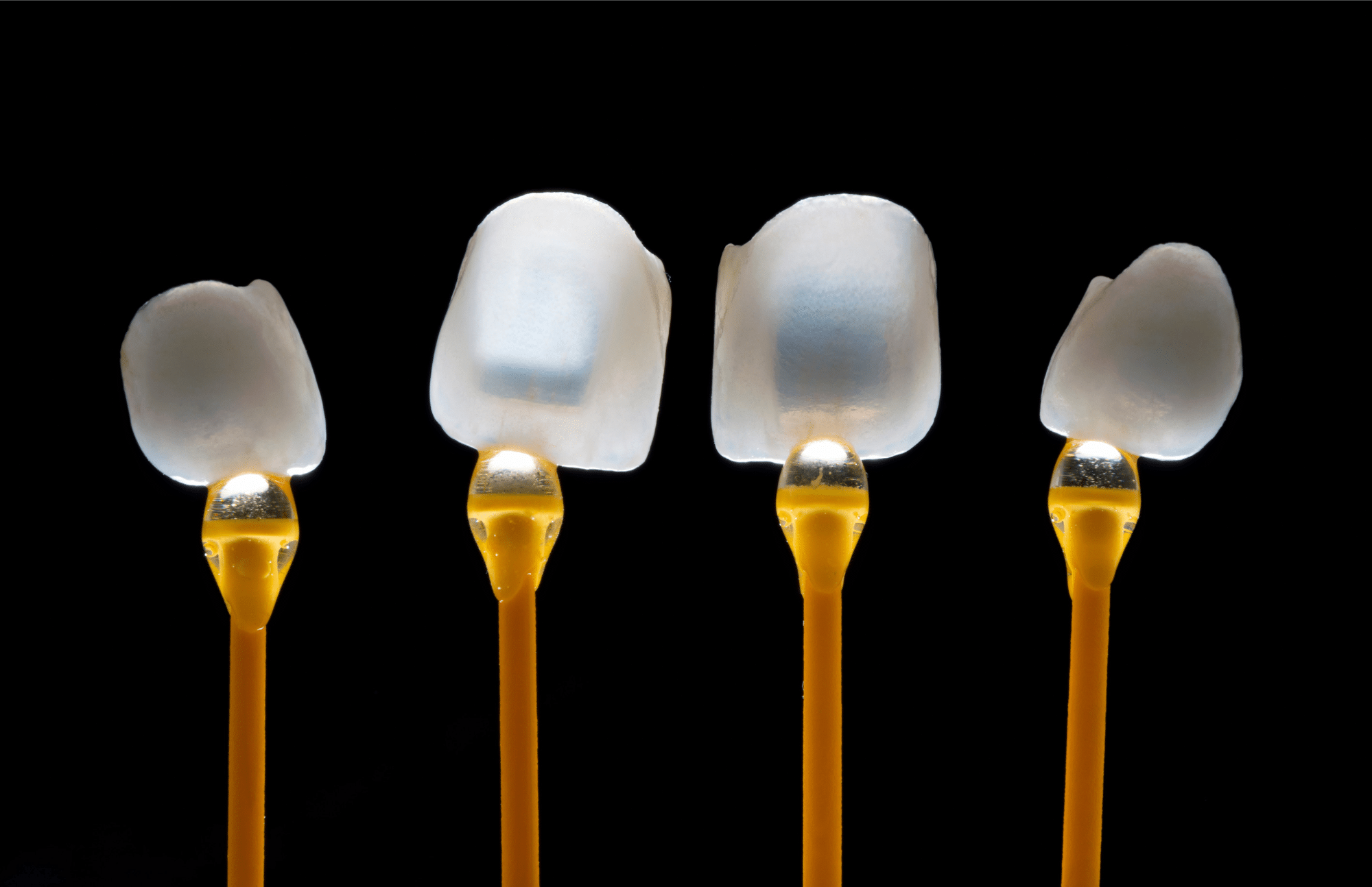 a close up photo of porcelain dental veneers at Pacific Northwest Smiles at Mill Creek